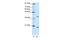 Zinc Finger Protein 322 antibody, PA5-41636, Invitrogen Antibodies, Western Blot image 