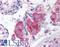 Cell Death Inducing DFFA Like Effector A antibody, LS-B703, Lifespan Biosciences, Immunohistochemistry frozen image 