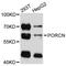 Probable protein-cysteine N-palmitoyltransferase porcupine antibody, abx126395, Abbexa, Western Blot image 