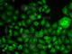 Cortactin antibody, A5795, ABclonal Technology, Immunofluorescence image 