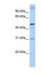 Acyl-CoA Binding Domain Containing 5 antibody, NBP1-59820, Novus Biologicals, Western Blot image 