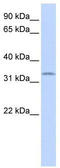 SRY-Box 1 antibody, TA329398, Origene, Western Blot image 