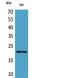 Mesencephalic Astrocyte Derived Neurotrophic Factor antibody, A03825, Boster Biological Technology, Western Blot image 