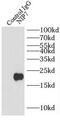 Nucleolar Pre-RRNA Processing Protein NIP7 antibody, FNab05736, FineTest, Immunoprecipitation image 