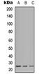 Immunoglobulin Lambda Like Polypeptide 1 antibody, abx121569, Abbexa, Western Blot image 