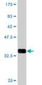 Fetal and adult testis-expressed transcript protein antibody, H00089885-M06, Novus Biologicals, Western Blot image 