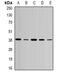 Aurora Kinase C antibody, abx142028, Abbexa, Western Blot image 