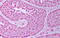 HSP90 antibody, MBS246339, MyBioSource, Immunohistochemistry paraffin image 