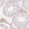 Complement Factor H Related 2 antibody, NBP2-48947, Novus Biologicals, Immunohistochemistry paraffin image 