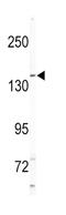 Mitogen-Activated Protein Kinase Kinase Kinase Kinase 4 antibody, abx033810, Abbexa, Western Blot image 