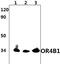 Olfactory Receptor Family 4 Subfamily B Member 1 antibody, PA5-75956, Invitrogen Antibodies, Western Blot image 