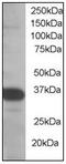 Single-strand selective monofunctional uracil DNA glycosylase antibody, AP08884PU-N, Origene, Western Blot image 