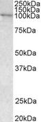 Vav Guanine Nucleotide Exchange Factor 3 antibody, PA5-18296, Invitrogen Antibodies, Western Blot image 