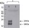 Thymic Stromal Lymphopoietin antibody, DDX0804B, Novus Biologicals, Western Blot image 