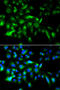 MYD88 Innate Immune Signal Transduction Adaptor antibody, STJ24659, St John