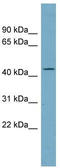 Arylacetamide Deacetylase Like 4 antibody, TA336097, Origene, Western Blot image 