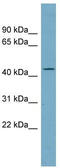 Arylacetamide Deacetylase Like 4 antibody, TA336097, Origene, Western Blot image 