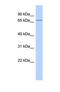 Leucine Rich Repeats And Calponin Homology Domain Containing 4 antibody, NBP1-69266, Novus Biologicals, Western Blot image 