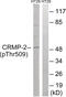 Dihydropyrimidinase Like 2 antibody, 79-905, ProSci, Western Blot image 