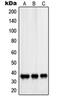 PDZ And LIM Domain 1 antibody, orb214862, Biorbyt, Western Blot image 