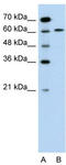 Apoptosis Inducing Factor Mitochondria Associated 1 antibody, TA330318, Origene, Western Blot image 