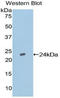 TIMP Metallopeptidase Inhibitor 2 antibody, LS-C296673, Lifespan Biosciences, Western Blot image 