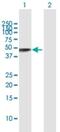 Galactosidase Alpha antibody, H00002717-D01, Novus Biologicals, Western Blot image 