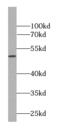 Histone Deacetylase 3 antibody, FNab03799, FineTest, Western Blot image 