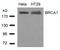 BRCA1 DNA Repair Associated antibody, GTX50557, GeneTex, Western Blot image 