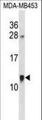 Acyl-CoA Binding Domain Containing 7 antibody, LS-C155918, Lifespan Biosciences, Western Blot image 