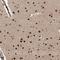 Zinc Finger Protein 280D antibody, HPA030233, Atlas Antibodies, Immunohistochemistry frozen image 