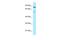 Sp9 Transcription Factor antibody, A07354, Boster Biological Technology, Western Blot image 