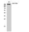 AT-rich interactive domain-containing protein 1B antibody, A02556-1, Boster Biological Technology, Western Blot image 