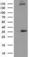 Nudix Hydrolase 6 antibody, M08301, Boster Biological Technology, Western Blot image 