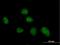 COP9 Signalosome Subunit 8 antibody, H00010920-B02P, Novus Biologicals, Immunocytochemistry image 