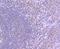 YY1 Transcription Factor antibody, A00833, Boster Biological Technology, Immunohistochemistry paraffin image 