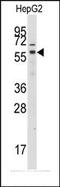 G Protein-Coupled Receptor Kinase 7 antibody, AP14494PU-N, Origene, Western Blot image 