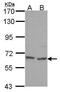 Bifunctional polynucleotide phosphatase/kinase antibody, GTX107488, GeneTex, Western Blot image 