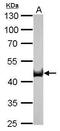 Citrate synthetase antibody, MA5-17265, Invitrogen Antibodies, Western Blot image 