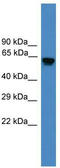 Ubiquitin Specific Peptidase 17 Like Family Member 2 antibody, TA342557, Origene, Western Blot image 