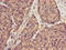 Small ubiquitin-related modifier 3 antibody, LS-C679695, Lifespan Biosciences, Immunohistochemistry paraffin image 