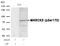 Myristoylated Alanine Rich Protein Kinase C Substrate antibody, P04133, Boster Biological Technology, Western Blot image 