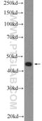 Zinc Finger DHHC-Type Containing 7 antibody, 25985-1-AP, Proteintech Group, Western Blot image 