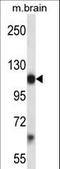 Platelet Derived Growth Factor Receptor Alpha antibody, LS-C164521, Lifespan Biosciences, Western Blot image 