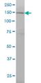 Ring Finger Protein 123 antibody, H00063891-M01, Novus Biologicals, Western Blot image 