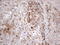 Secreted Frizzled Related Protein 2 antibody, LS-C794043, Lifespan Biosciences, Immunohistochemistry paraffin image 