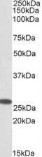 Coiled-Coil-Helix-Coiled-Coil-Helix Domain Containing 3 antibody, NBP1-52009, Novus Biologicals, Western Blot image 