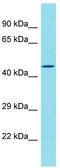 Protein DBF4 homolog B antibody, TA335452, Origene, Western Blot image 