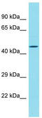 DBF4 Zinc Finger B antibody, TA335452, Origene, Western Blot image 