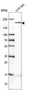 Platelet Derived Growth Factor Receptor Beta antibody, HPA028499, Atlas Antibodies, Western Blot image 